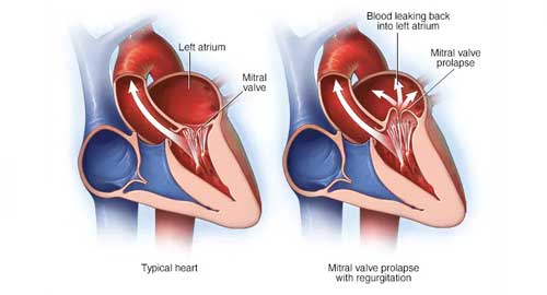 Famous Cardiologist in Hyderabad